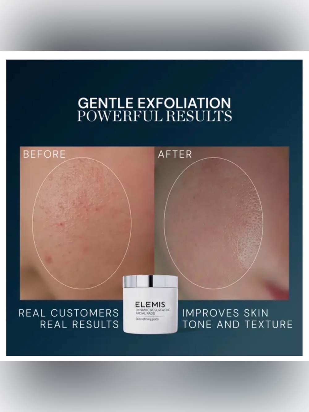 ELEMIS Dynamic Resurfacing Facial Pads - Picture 3 of 7